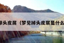 梦见掉头皮屑（梦见掉头皮屑是什么意思）