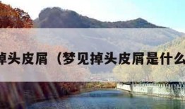 梦见掉头皮屑（梦见掉头皮屑是什么意思）